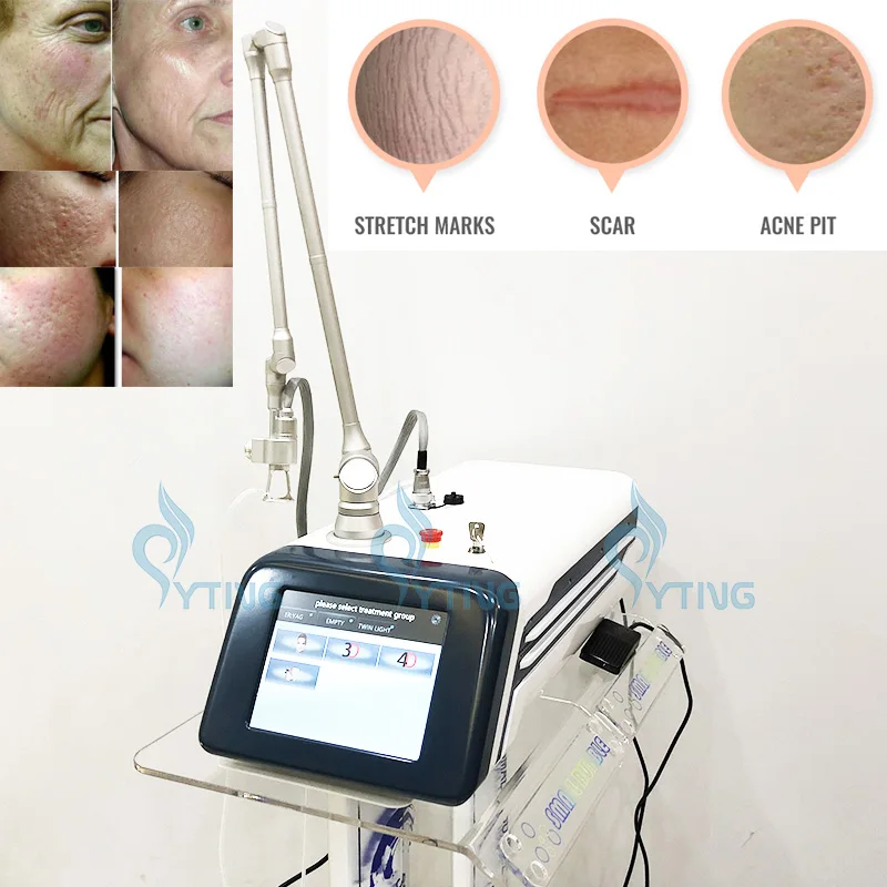 CO2 Fractional Laser Skin Rejuvnation Ance Treatment Scar Removal Mole Warts Removal Sretch Mark Treatment Vaginal Tightening