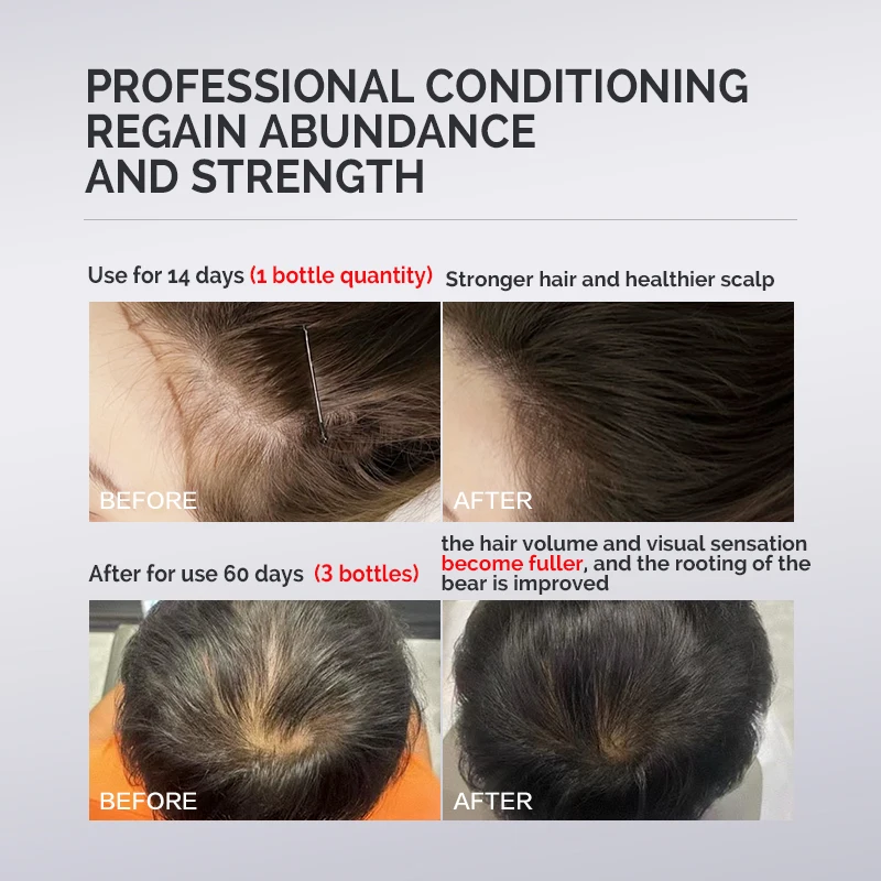 Borala Advanced Technological Hair Growth Hair Growth Support Ages 45 and Up for Visibly Thicker Hair and Scalp Coverage