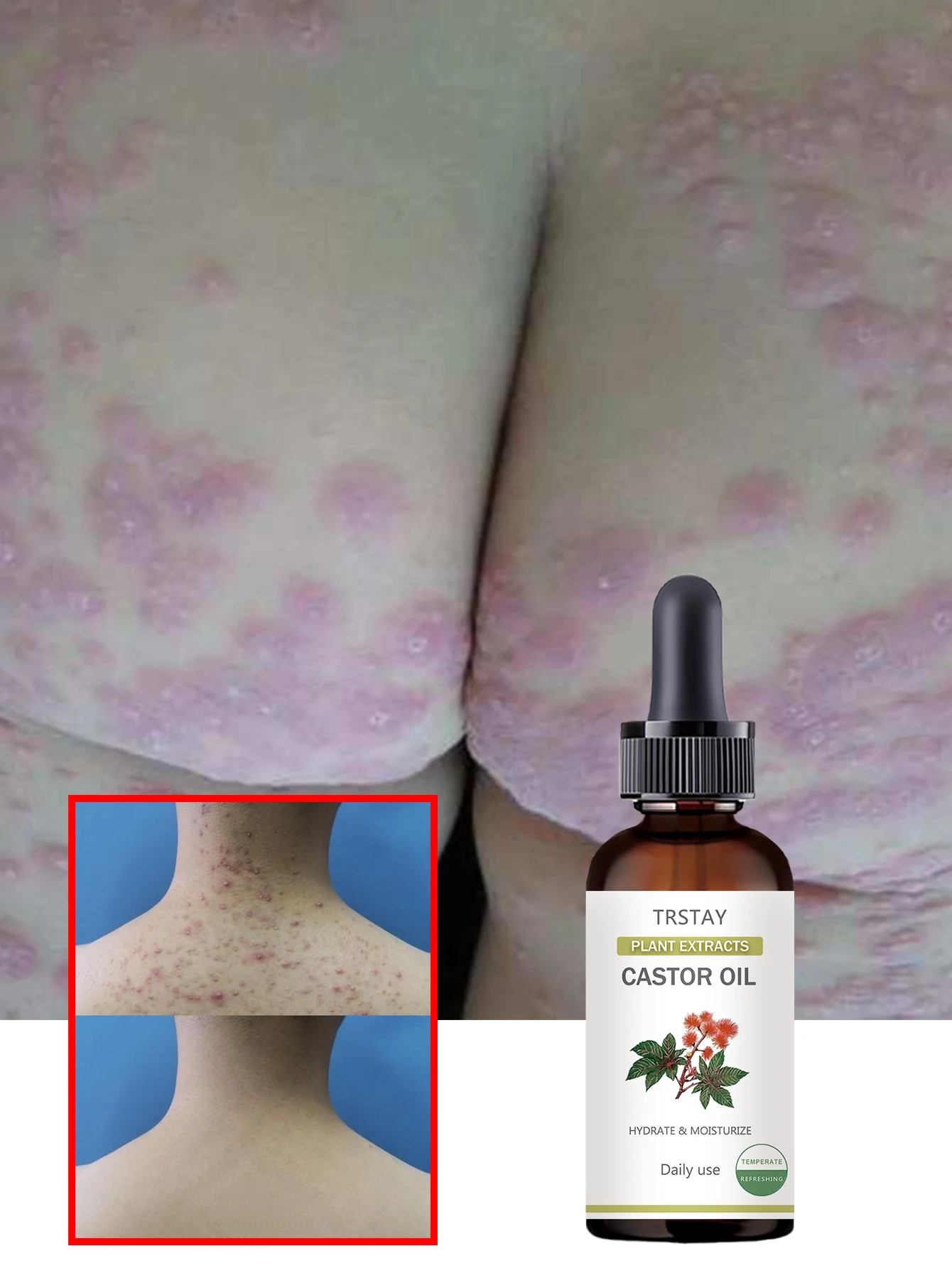 Aceite para el cuidado corporal sin perfume con vitamina E Hidrata profundamente ilumina y suaviza la piel para un brillo radiante Perfecto para hidratación diaria