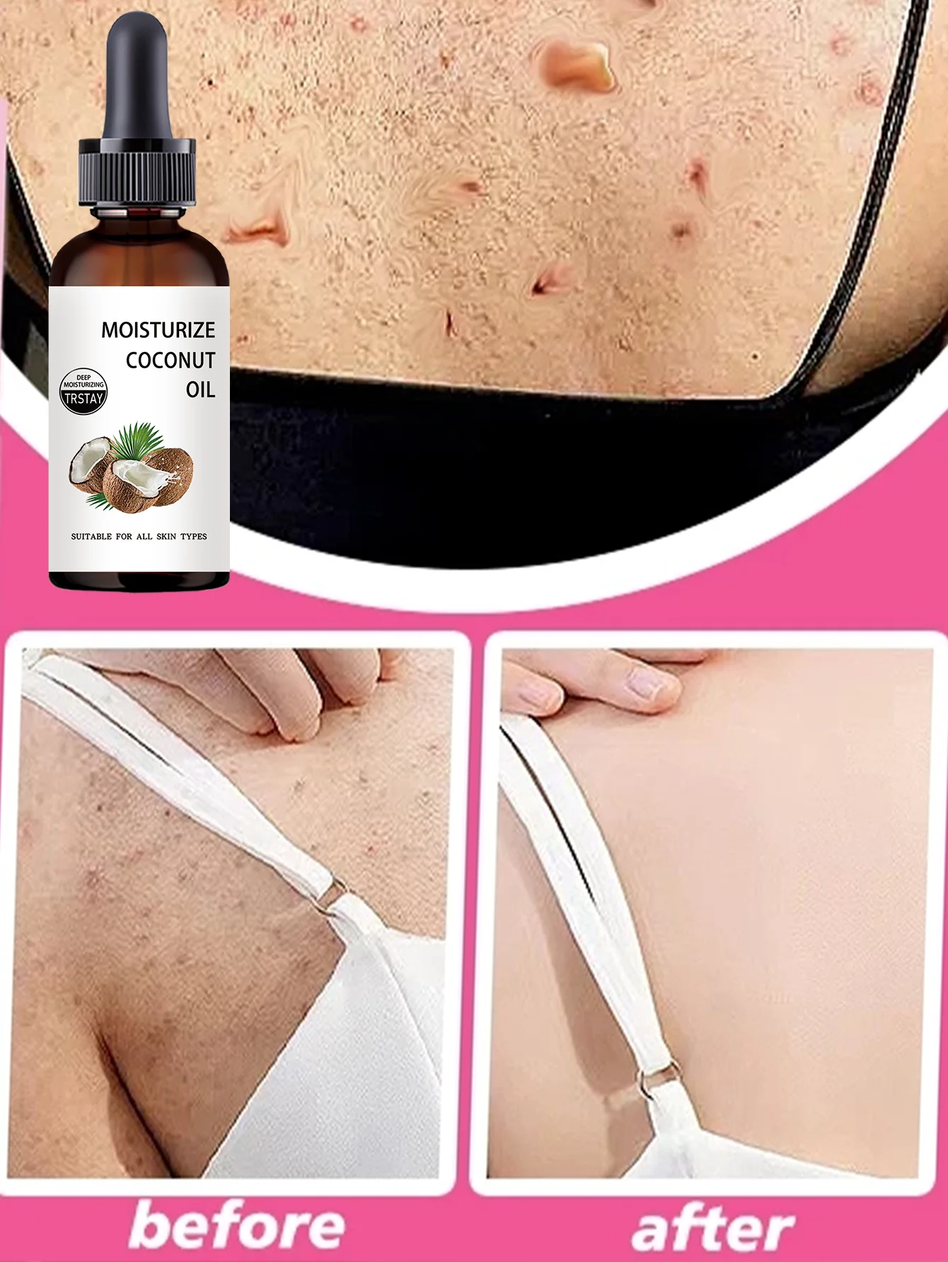 Unscented Body Moisturizing Oil with Vitamin E Formula for Long Lasting Hydration to Improve Dullness and Dryness Perfect for Da - Image 2