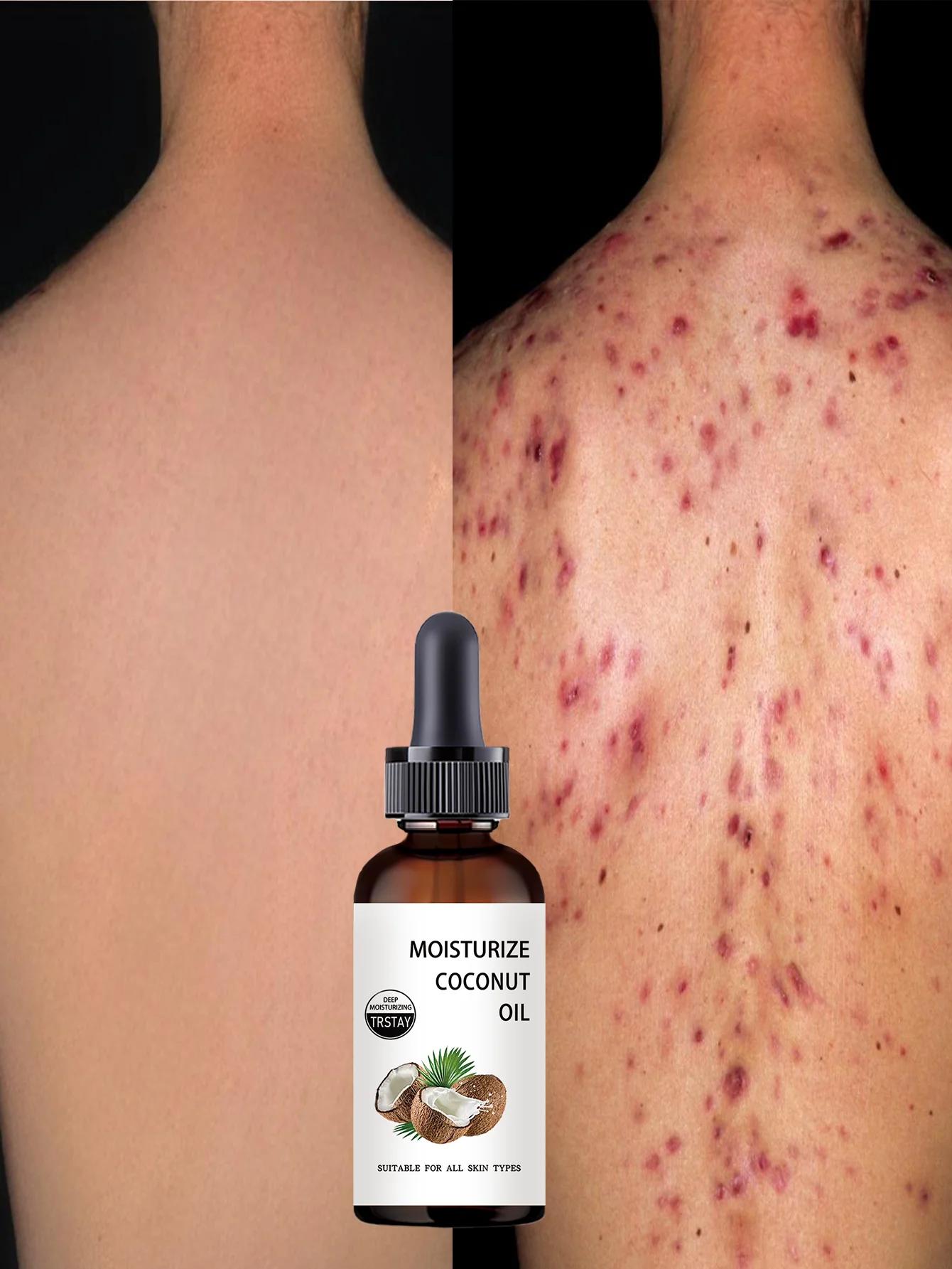 Unscented Body Moisturizing Oil with Vitamin E Formula for Long Lasting Hydration to Improve Dullness and Dryness Perfect for Da - Image 4