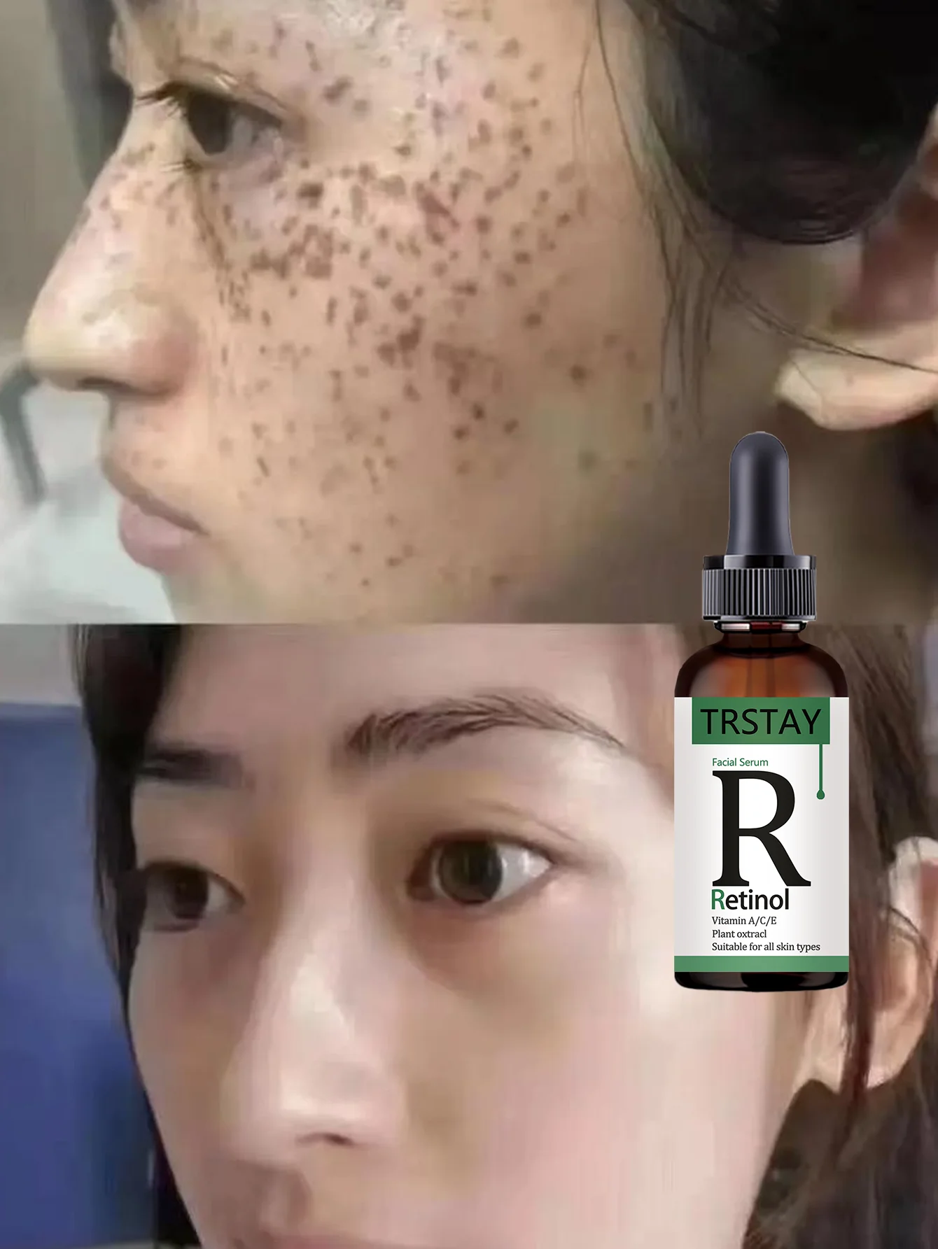 Moisturizing firming whitening serum soothes sensitive skin tightens pores restores elasticity enhances texture for radiant comp