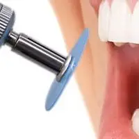 

40/80pcs Dental Polishing Discs Gross Reduction Contouring Mandrel Stripes Set Materials Teeth Whitening 4 Color Disk