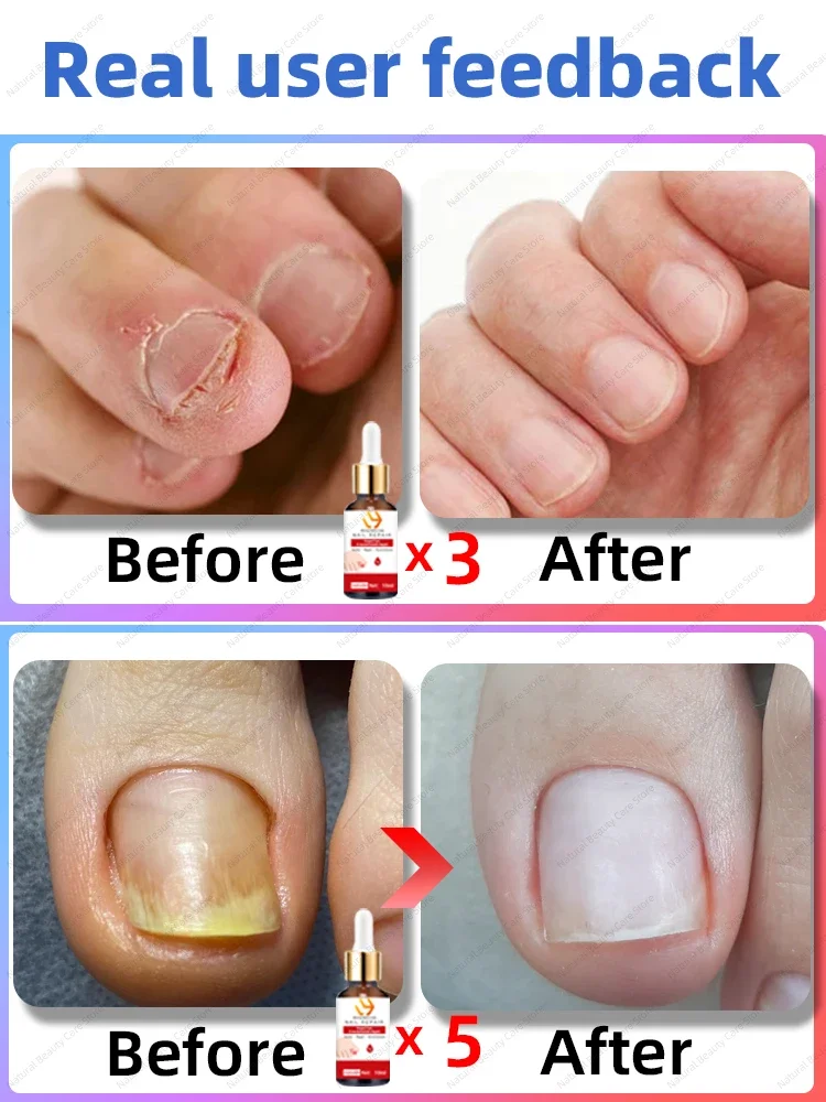 Solves all nails problem