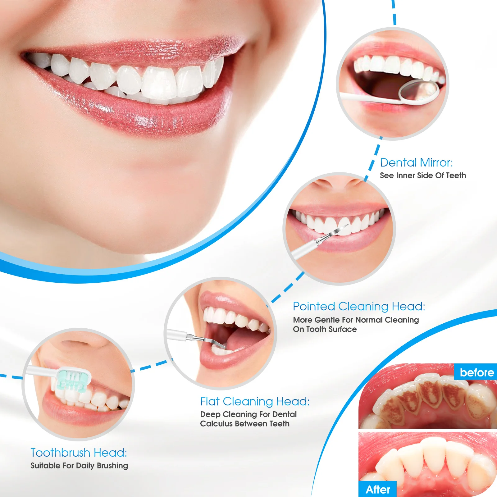 Cepillo de dientes eléctrico ultrasónico, removedor de sarro y cálculo, blanqueador Dental, resistente al agua