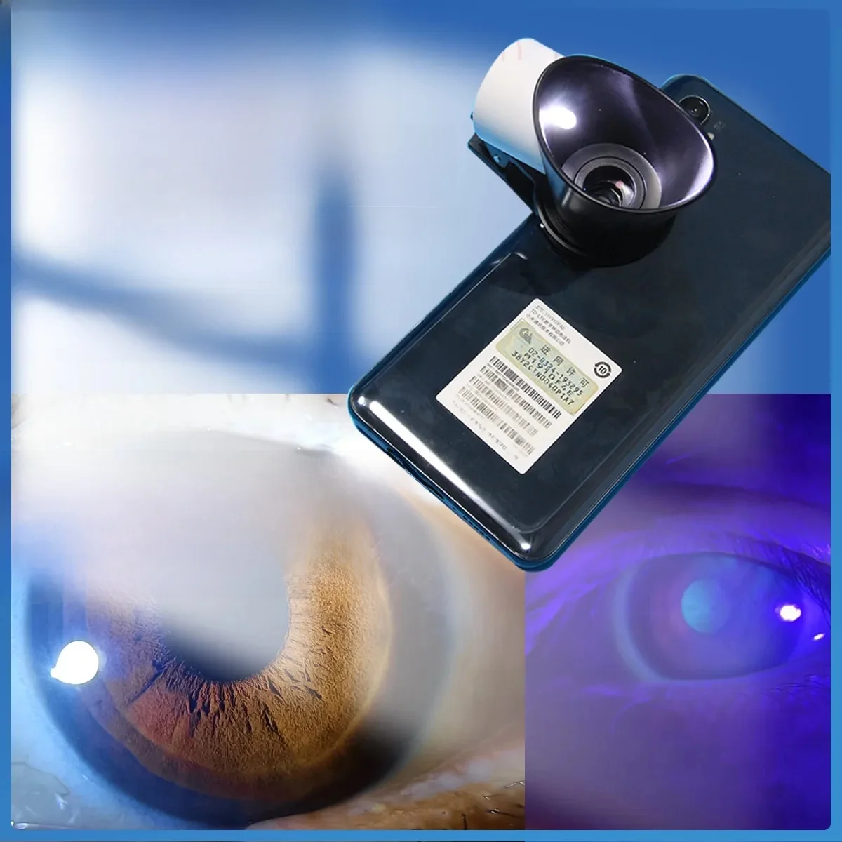 optometria Simple Iris Condition Checker | Adapter do telefonu komórkowego z powiększeniem 1.00X-3.00X | okulistyczny Taker zdjęć | Żarówka LED — zdjęcie 2