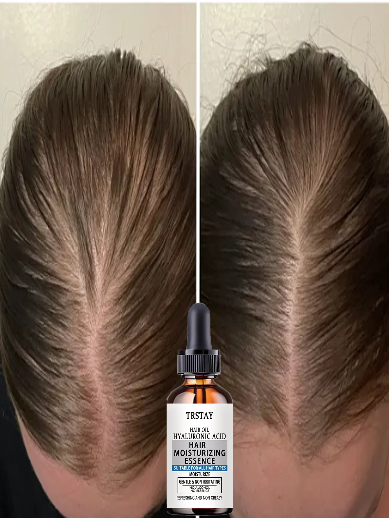 

Увлажняющее средство против выпадения волос для поврежденных волос Глубоко питает вьющиеся волосы Восстанавливает сухие секущиеся концы Восстанавливает эластичность St