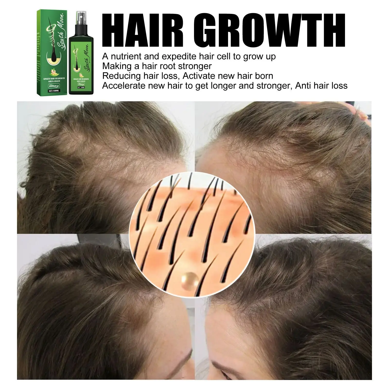South Moon Ginger Hair Growth Spray Hair Root Grow Smoothing Hairs Loss Serum Scalp Damaged Treatment Massage Hair Care Products - view 6