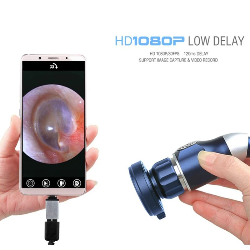 1080P Medical Endoscope Camera for ENT Surgery & Inspection - HDMI & USB Video Output for Clinic & Hospital Use