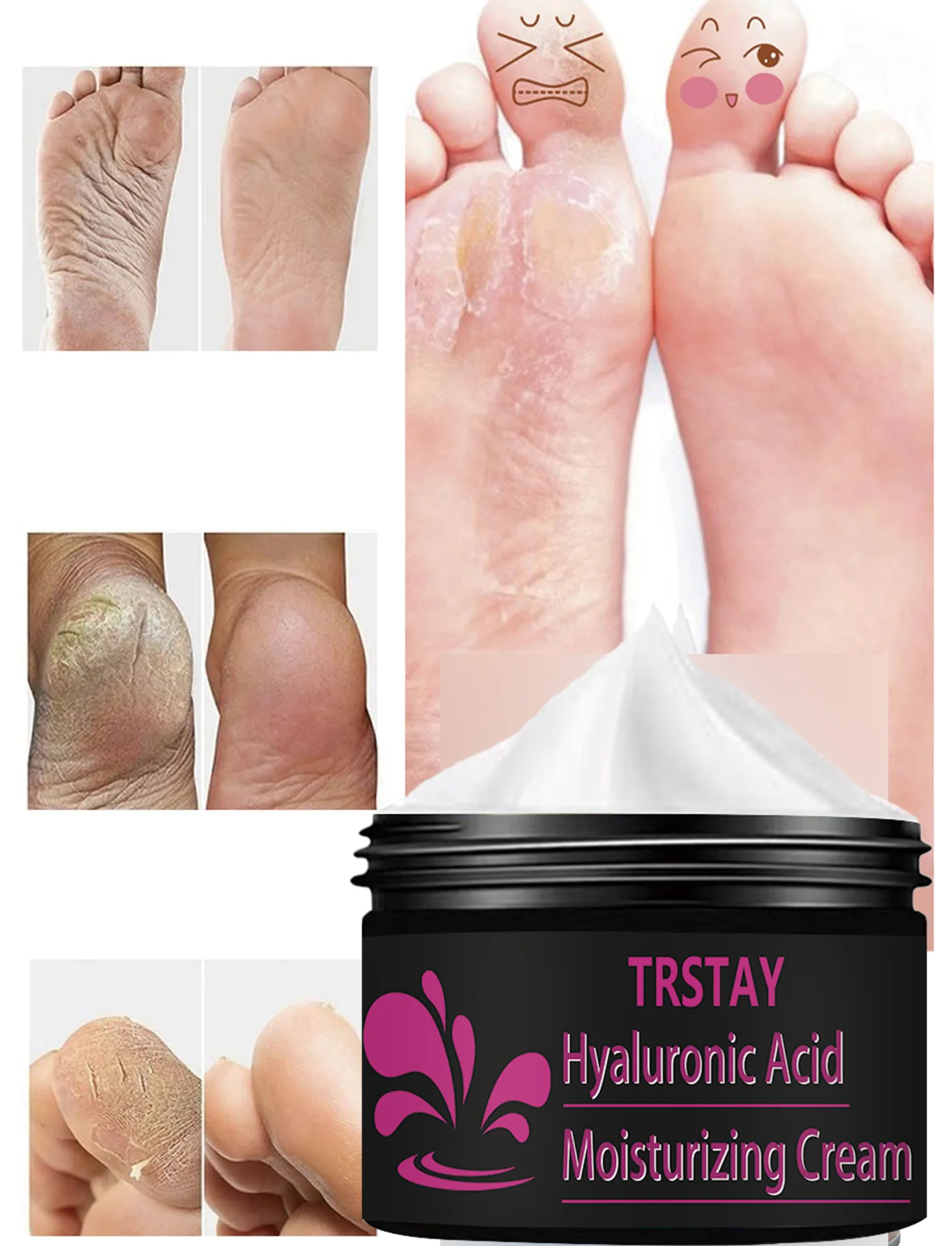 

Глубоко питательный крем для ног Интенсивное увлажняющее средство для лечения потрескавшихся пяток и грубой кожи с натуральным увлажняющим ингредиентом