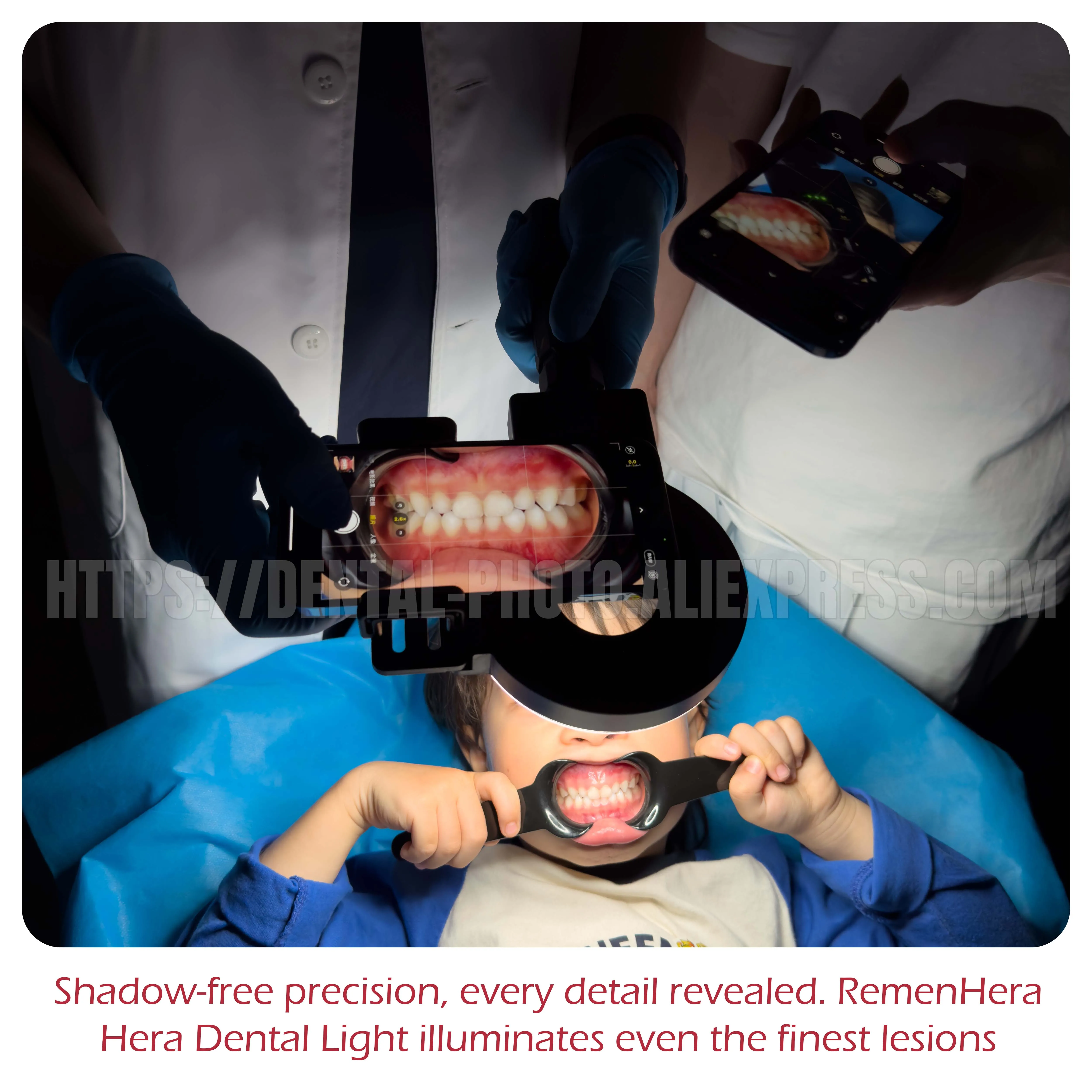 MK-023 Dentist Photography Ring Fill Light  Adjustable 2500-6500K 3-Color Temperature, Soft Diffuser, Oral & Intraoral Photo fo