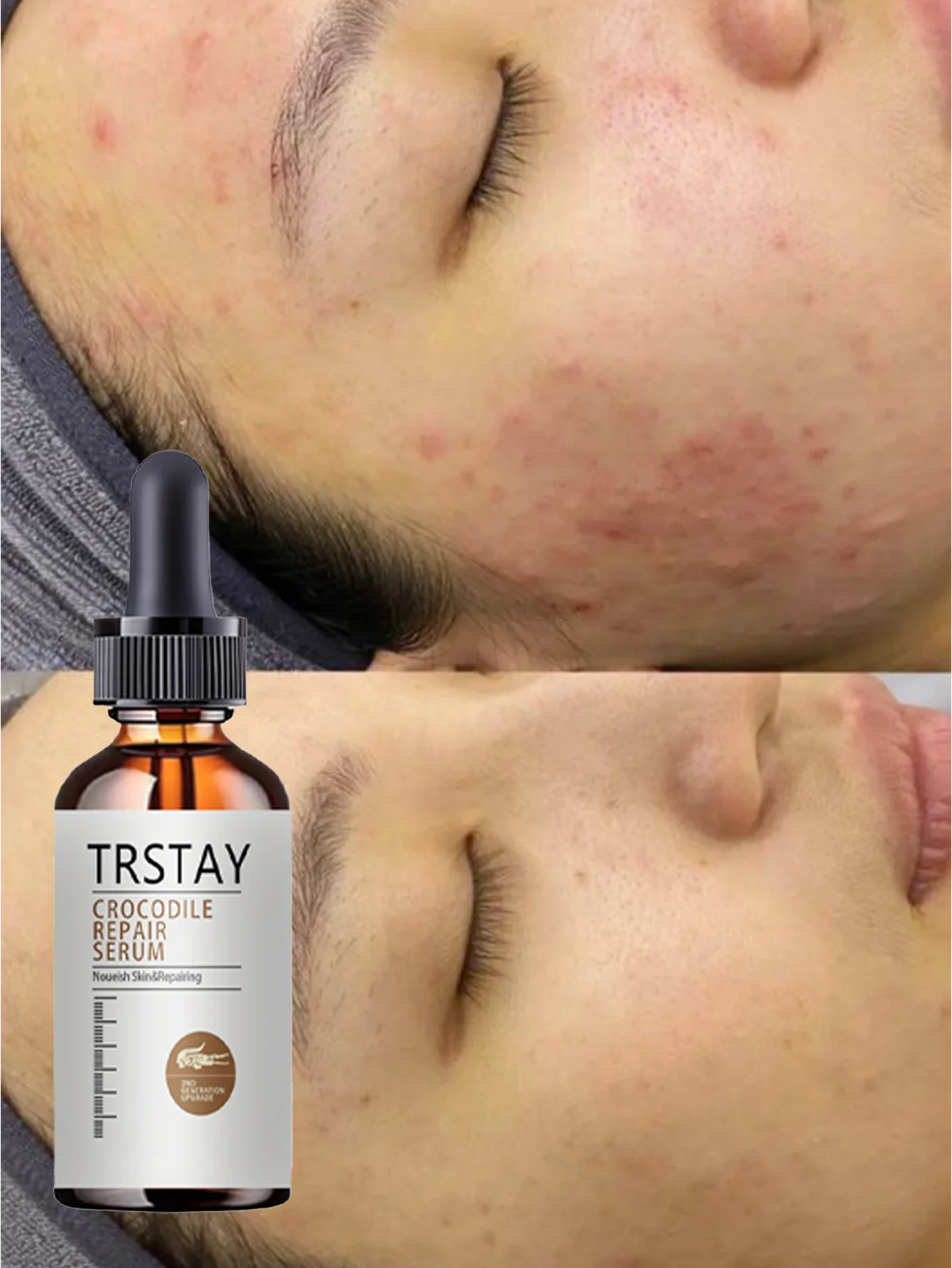 Moisturizing Essential Oil for Skin Hydration and Firming with Natural Extracts to Improve Elasticity and Reduce Wrinkles for Yo