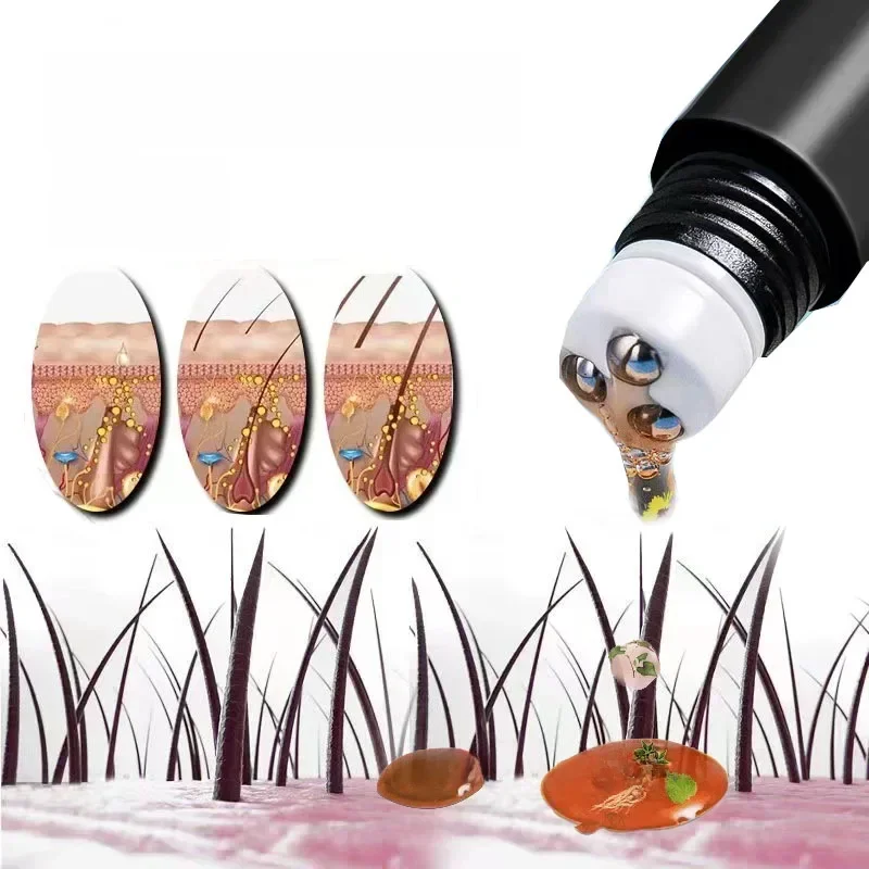 Biotine snelle haargroeiolie Producten Verzorging Hoofdhuid Massage Behandelingen Anti-haaruitval Effectief groeien Dikker haarserum voor mannen - afbeelding 2