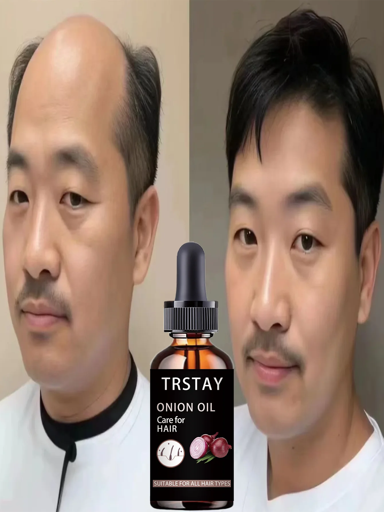 Moisturizing Intensive Curly Hair Treatment Deeply Hydrates Repairs Damaged Hair Boosts Elasticity Creates Soft Thick Dandruff F - Image 3