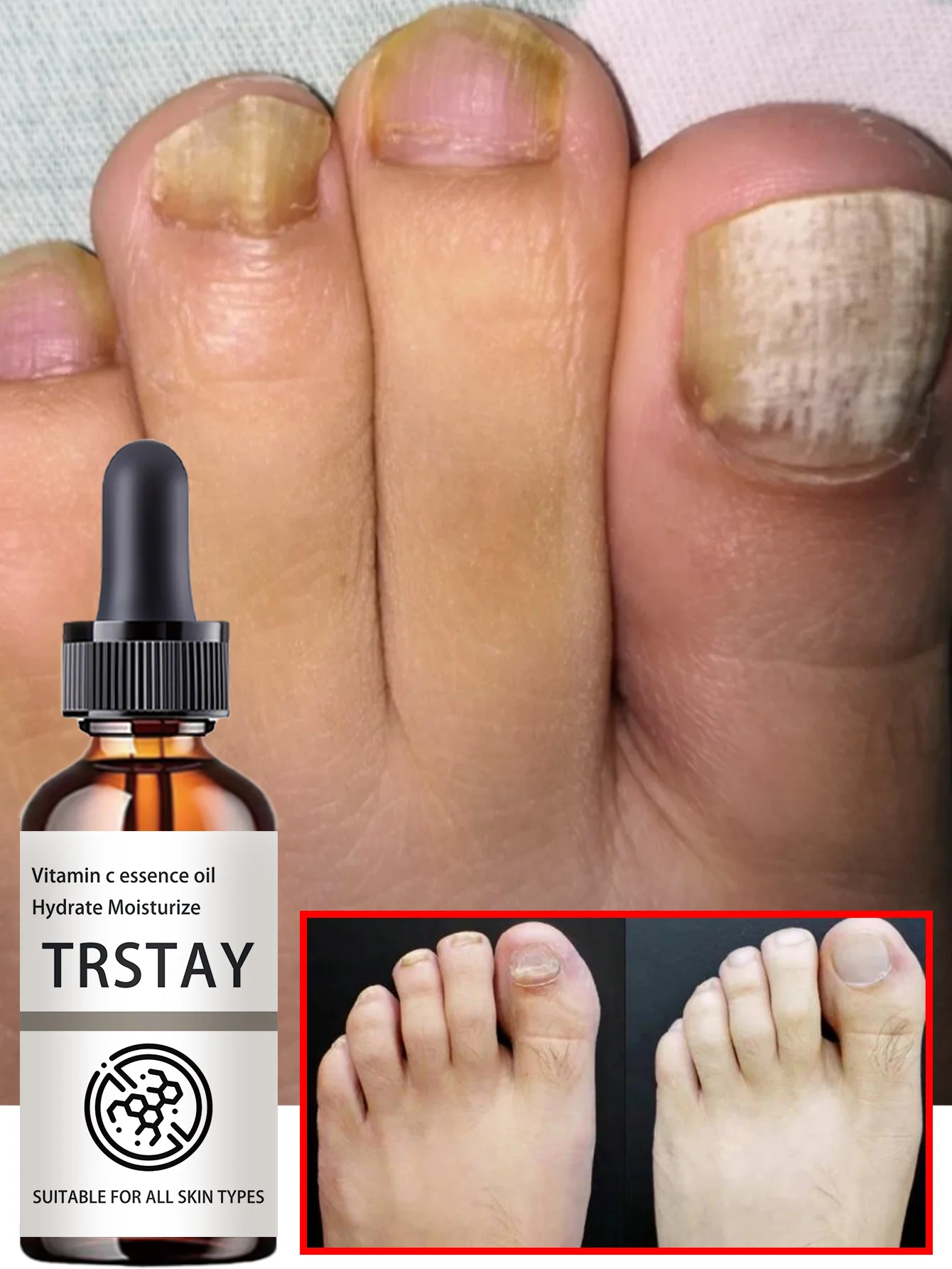 Aceite líquido suavizante para cutículas de uñas, hidratante, reparación nutritiva, secura, uñas colgantes, vitamina E, glicerina, cuidado saludable