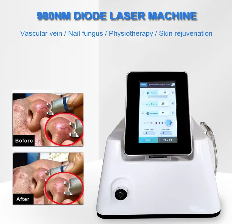 2 IN 1 980nm Laser Instrument Red Vascular Removal Nail Fungus Removal Spider Vein Elimination Machine