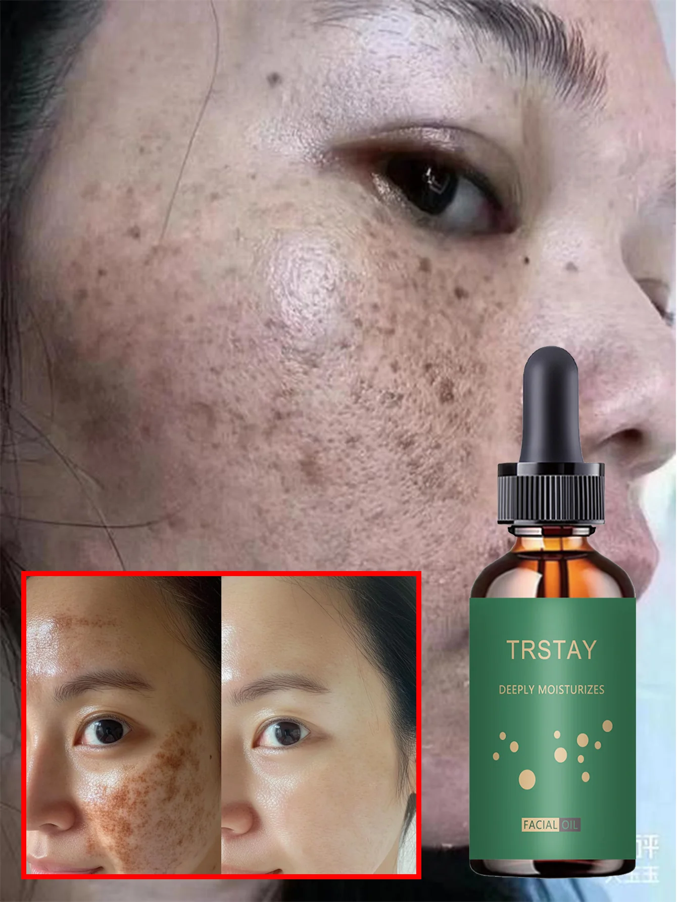 Facial Moisturizing Serum - Gentle and Non-Irritating, With Plant Extracts, Hydrating and Moisturizing, Suitable for All Skin Ty - Image 4