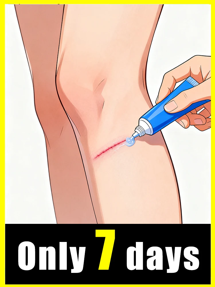 Reparación de cicatrices mejorada de tercera generación, erradia cicatrices en 7 días, diga adiós a las preocupaciones.