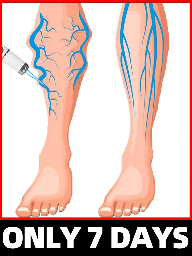 

Generation-3 Laser Says Goodbye To в 7 дней