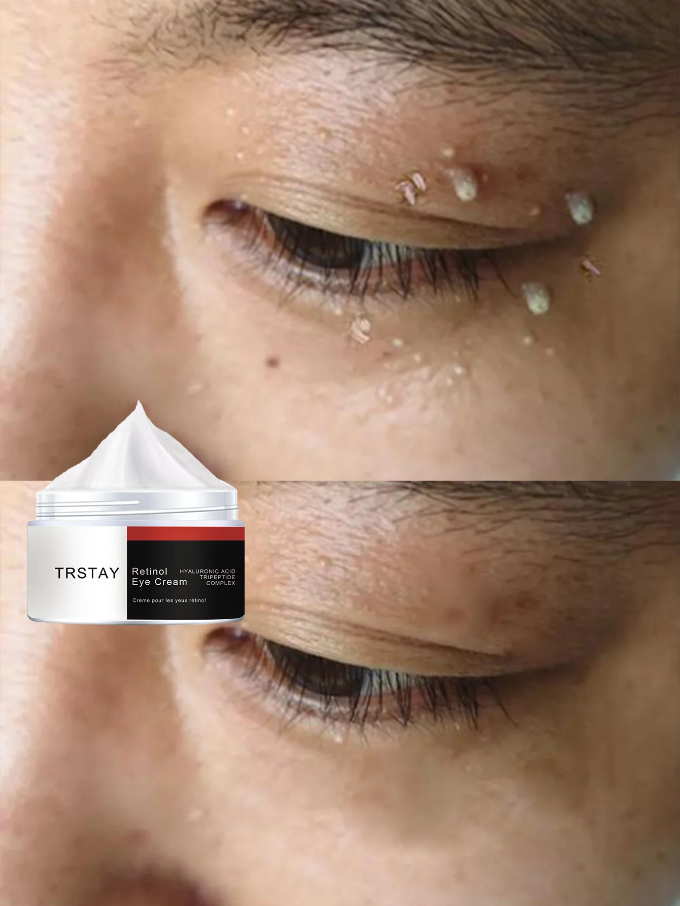 

Увлажняющая сыворотка для глаз от темных кругов и морщин, осветляющая лечение для подтяжки мешков и увлажнения для молодежи глаз