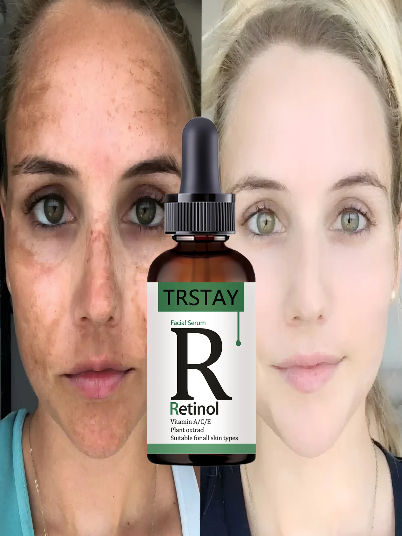 Moisturizing firming whitening serum soothes sensitive skin tightens pores restores elasticity enhances texture for radiant comp - Image 6