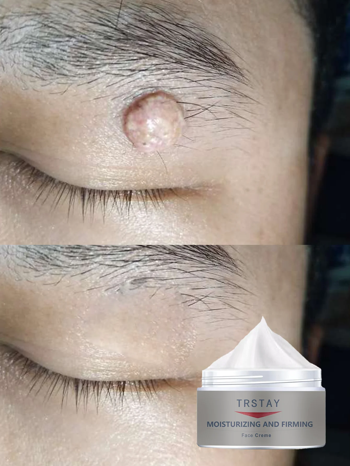 Eye care granule repair cream deeply moisturizes and soothes rough skin prevents dryness and cracking for smooth youthful appear - Image 3