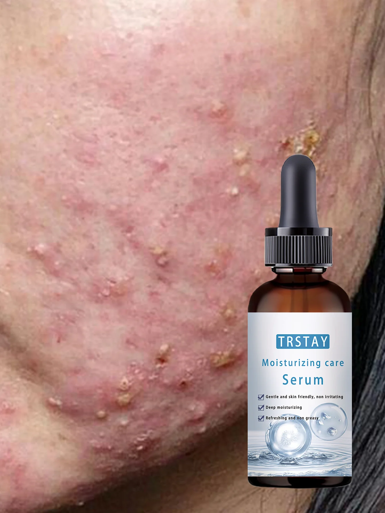 All Skin Types Brightening Serum Hydrates and Fights Acne Boosts Skin Elasticity Reduces Dryness and Looseness for Youthful Glow - Image 3