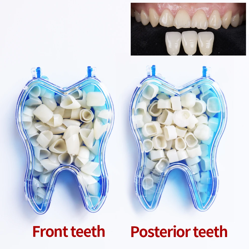 

50Pcs Dental Teeth Veneers Ultra Thin Whitening Resin Molar Anterior Temporary Crown Porcelain Dental Material Oral Care Tools