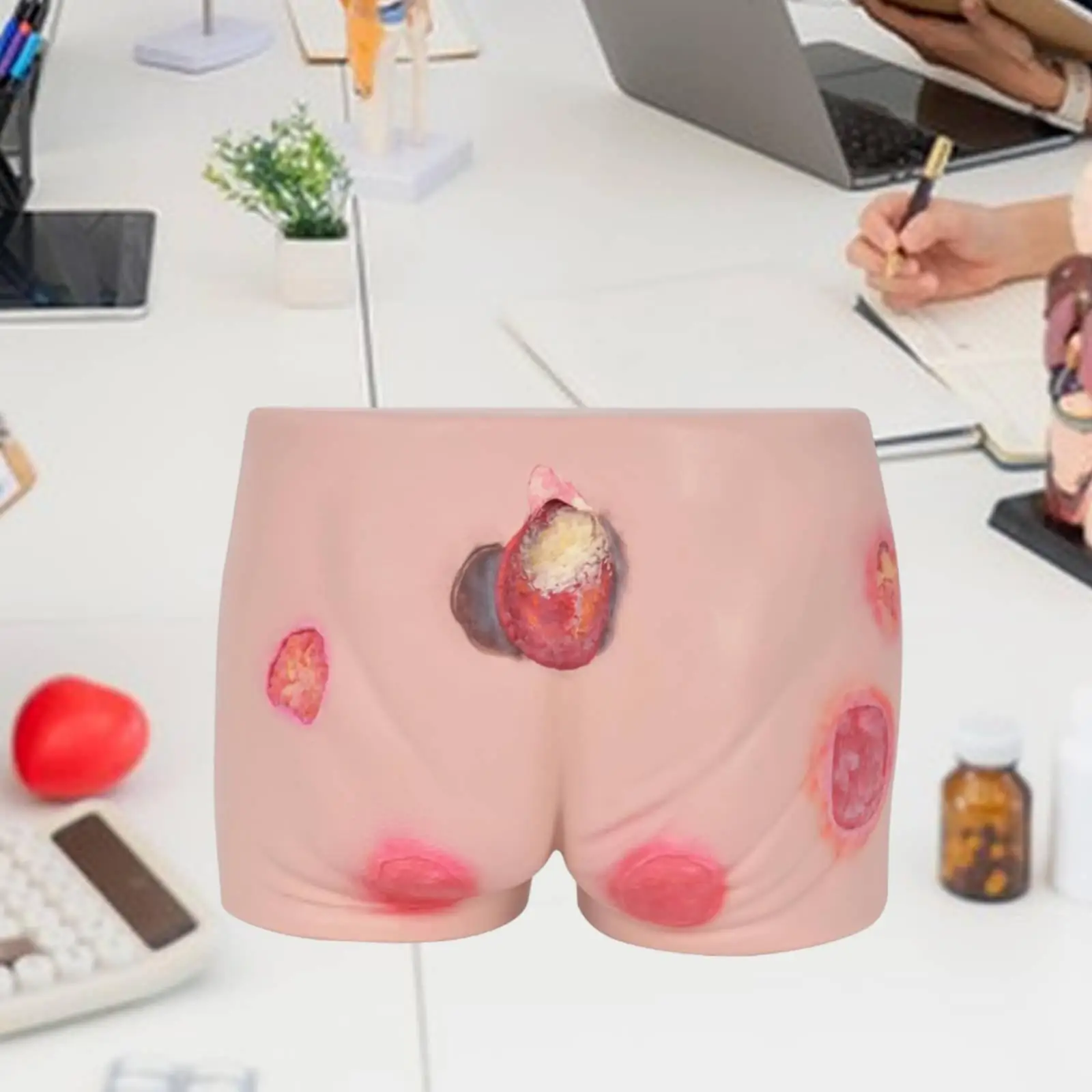 Pressure Ulcers Nursing Model Senior Pressure Ulcers Manikin Buttock Care Model Teaching Simulator Stu Education Medical Train - view 4