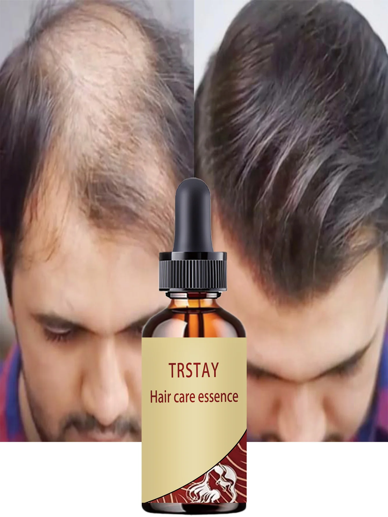 Moisturizing Split Ends Repair Essence Liquid For Damaged Hair Restore Luster Prevent Breakage Create Healthy Hair Treatment For - Image 4