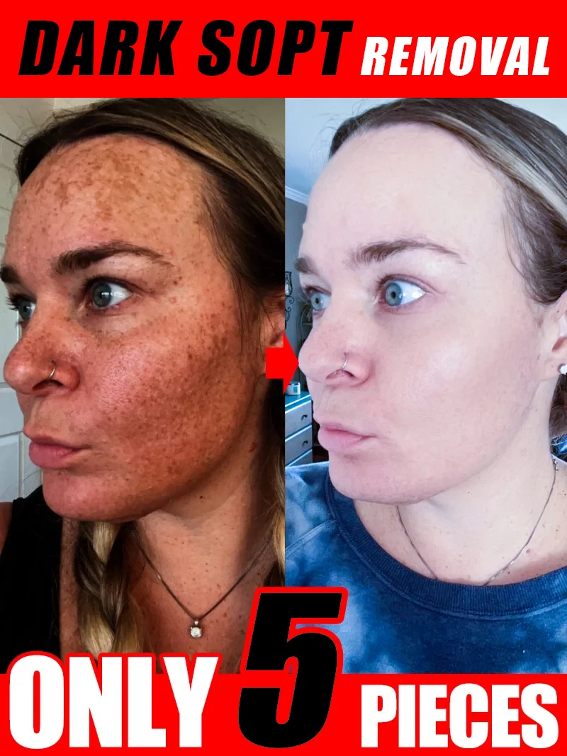 Luxury Natural Skincare - Krim Penghilang Bintik Hitam Untuk Wajah,