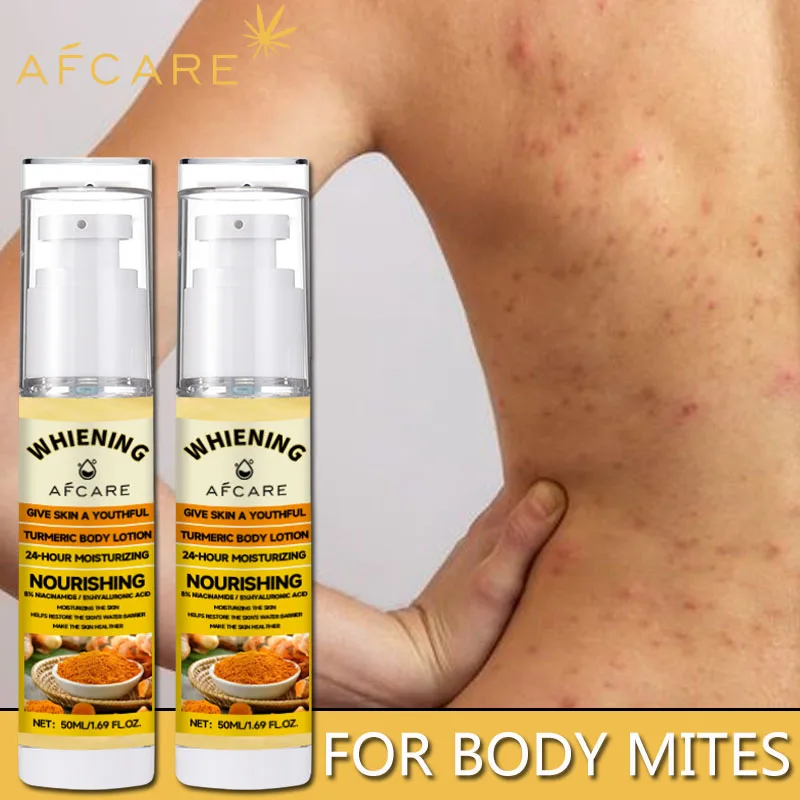 Turmeric Body Lotion Nourishes Dry Skin Moisturizing Fast Absorbing Non Greasy Lightweight Daily Skin Care Nicotinamide