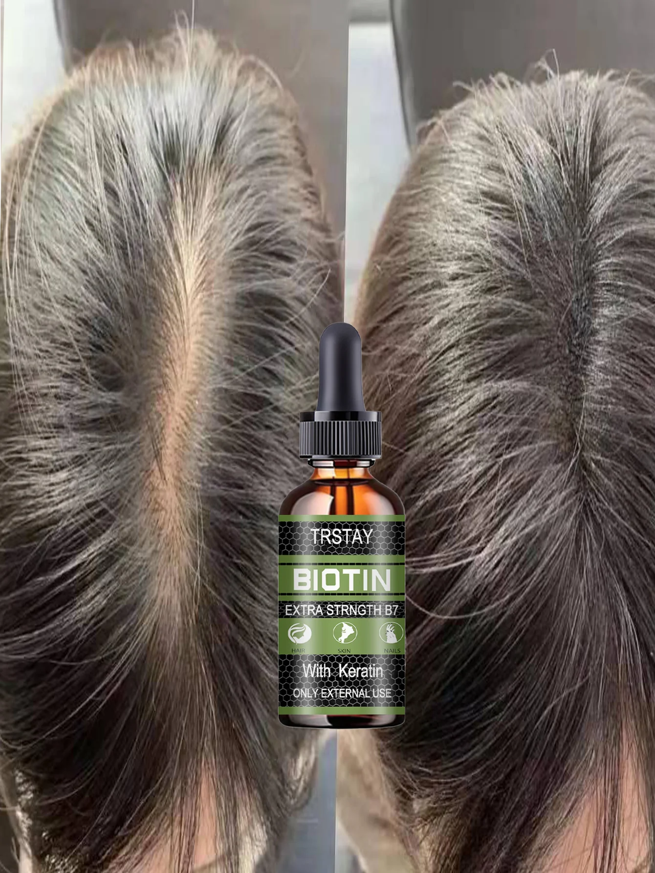 Moisturizing Hair Treatment Oil for Nourishing and Growing Your Hair Reduce Split Ends and Frizz for Thicker Fuller Healthier Lo - Image 5