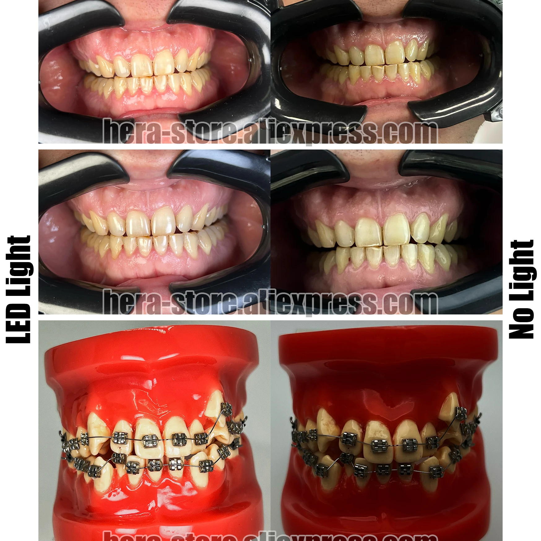 Fotografia stomatologiczna Lampa wypełniająca jamę ustną do sprzętu dentystycznego Stomatologia Ładowanie Oświetlenie Regulacja jasności Statyw. MK17