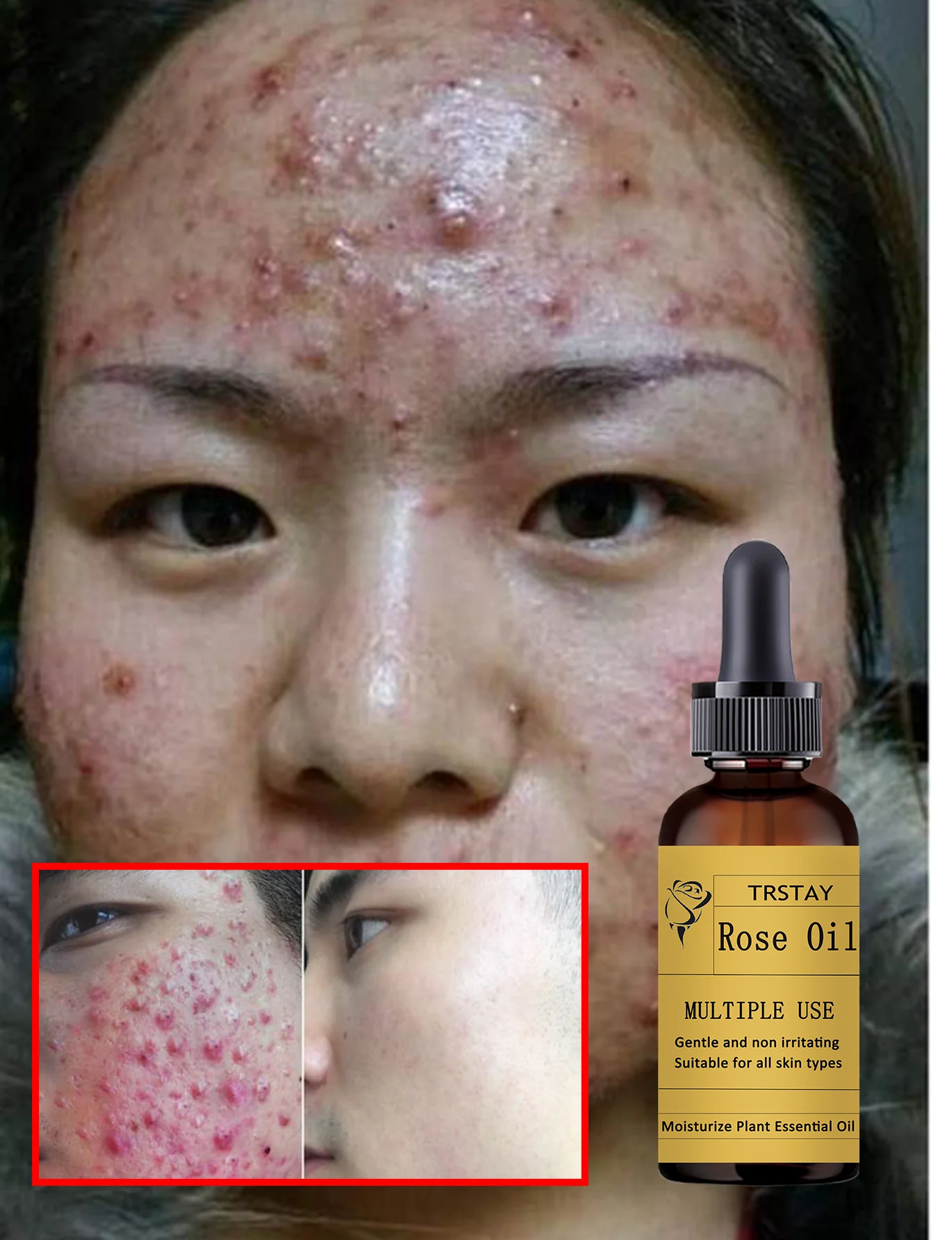 All-in-One Hydrating Serum for All Skin Types Fast-Absorbing Formula to Simplify Your Skincare Routine with Deep Moisture and No - Image 6