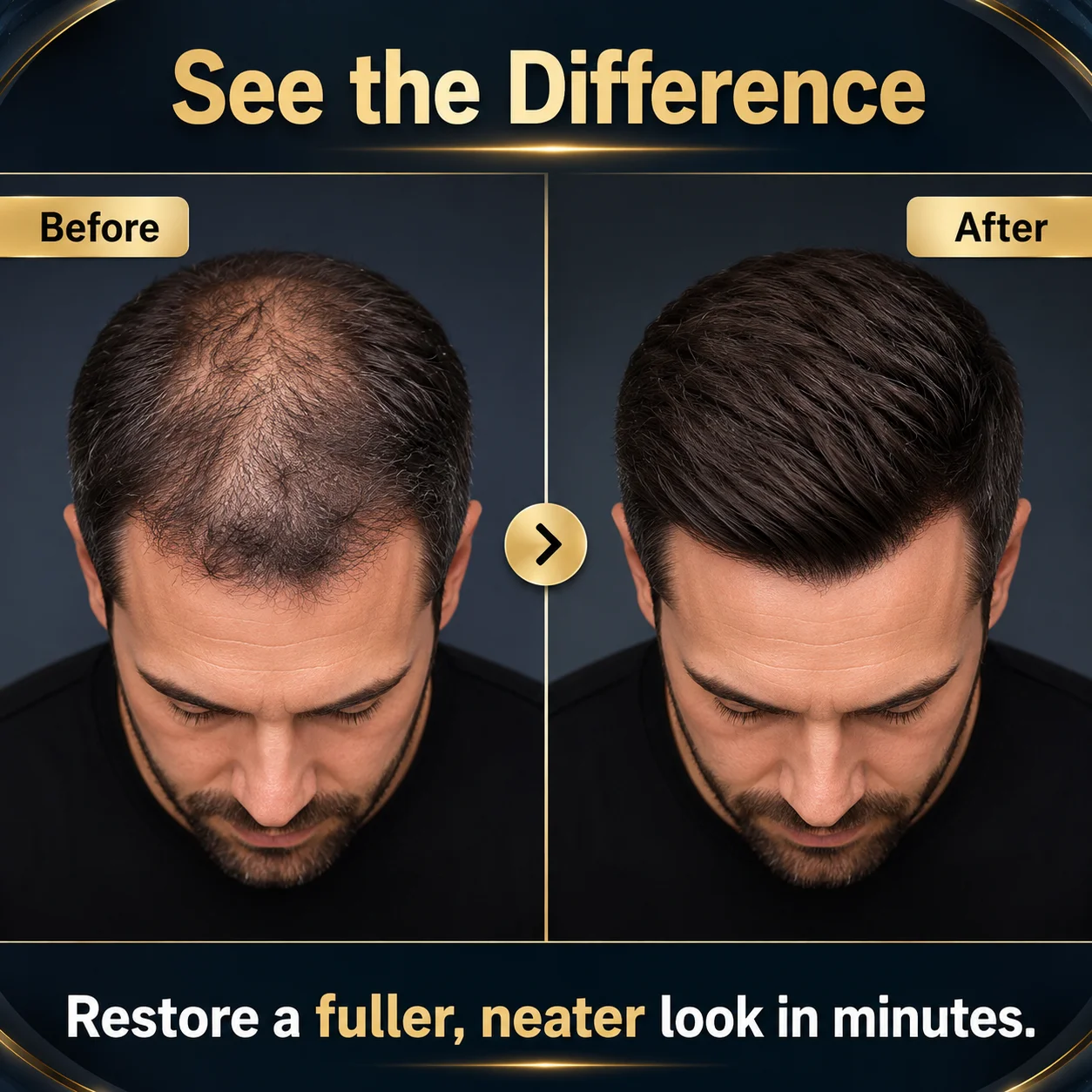 Thumbnail 4 - #50 Toupees Comparison Guide