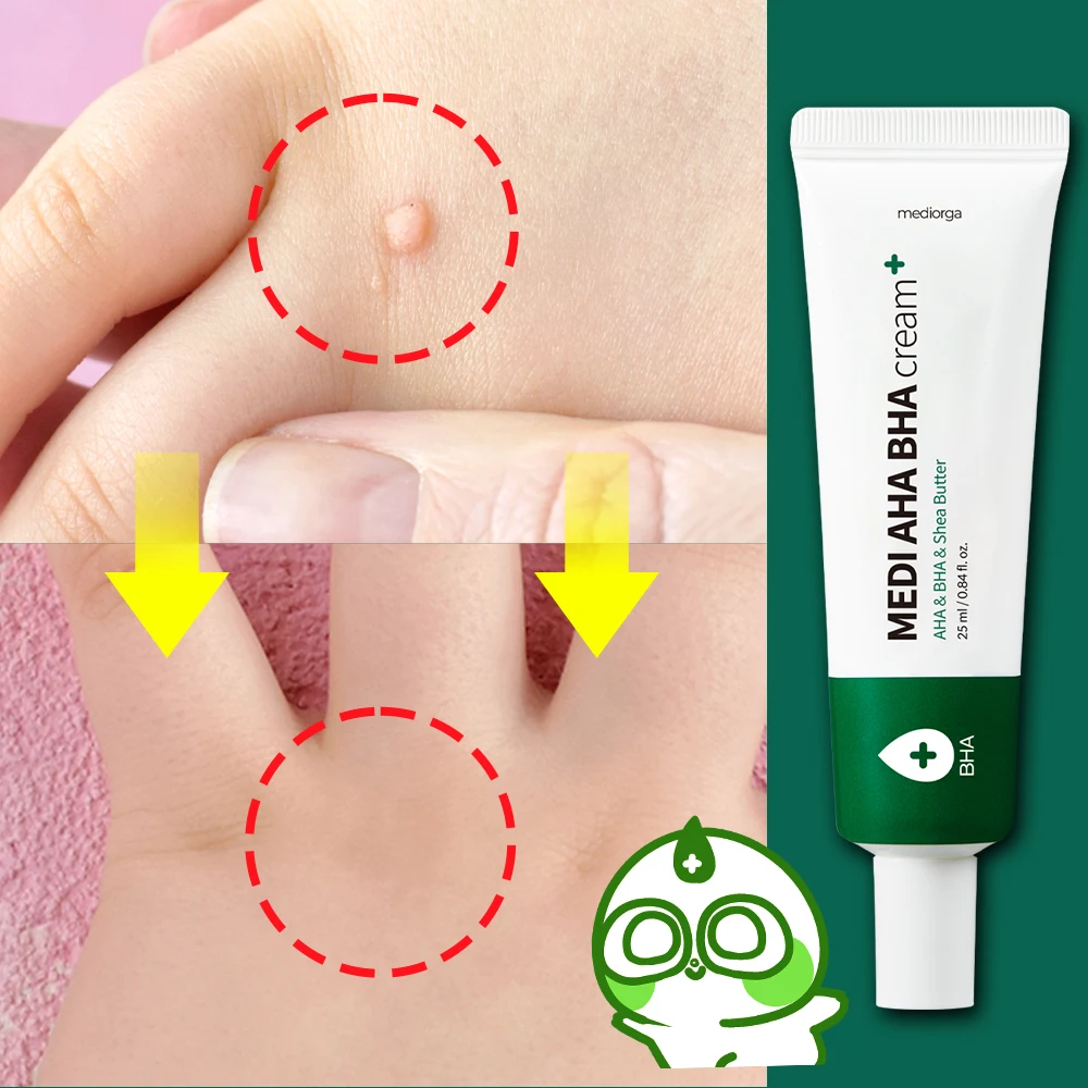 [AliExpress Meets Dangle!] Soothe Various Problematic Skin Concerns with Dangle's Low-Irritation AHA BHA Cream