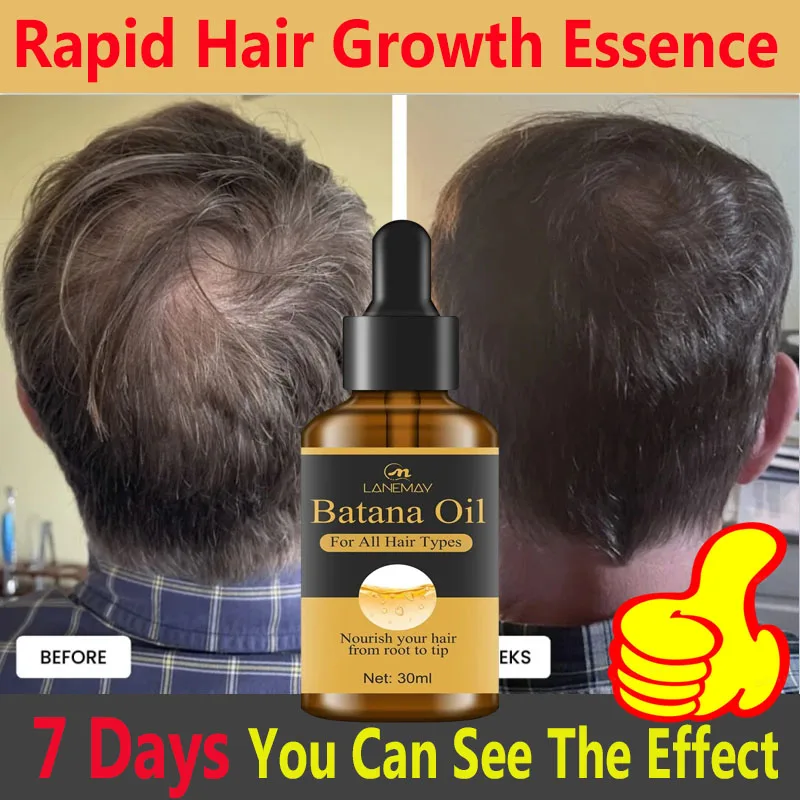 

Fast Hair Growth Set Batana Oil Traction Alopecia Hair Mask Anti Break Loss Hair Growth Oil Baldness Treatment Hair Health Care