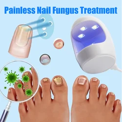 Fungal Nail Laser Device Repair Fast Onychomycosis Fungus Nails