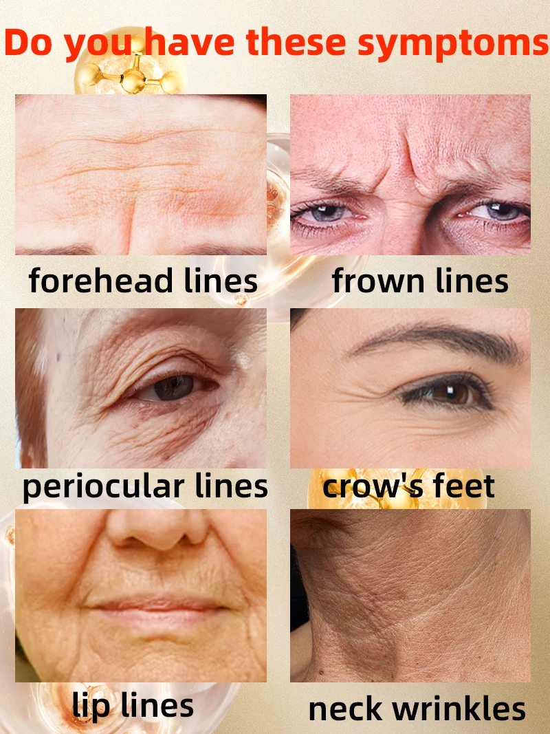Reverse Aging with Wrinkle Lifting