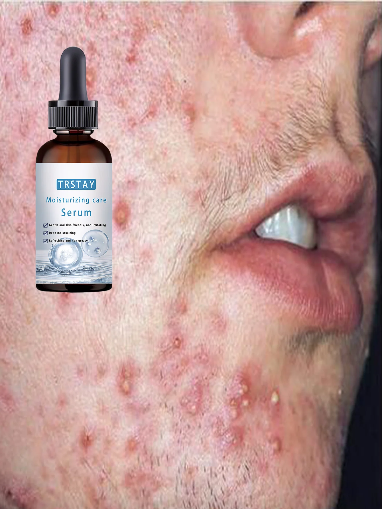 All Skin Types Brightening Serum Hydrates and Fights Acne Boosts Skin Elasticity Reduces Dryness and Looseness for Youthful Glow - Image 4