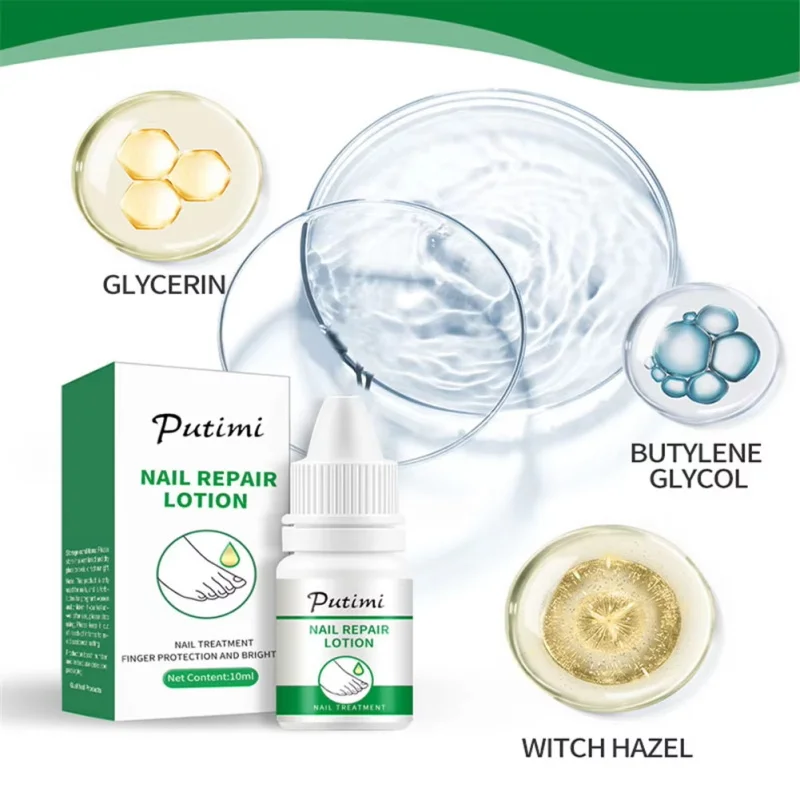 Fungal Nail Treatment Oil Foot Repair Essence เจลกําจัดเชื้อราเล็บเท้า ครีมป้องกันการติดเชื้อ Fungal Nail Removal