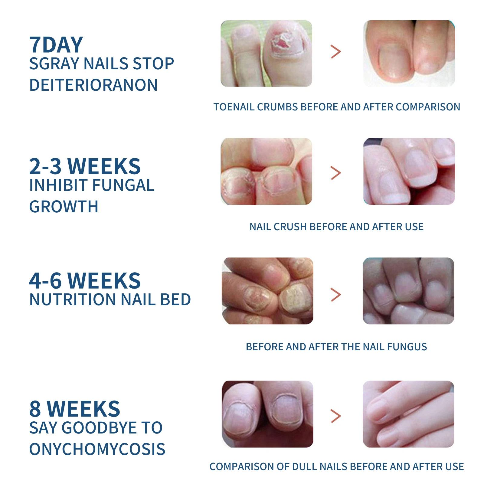 Toenail Care Patches Restored Shine Reduced Discoloration Thickness Improved Appearance Nourishing Repair Nail Treatment Patch