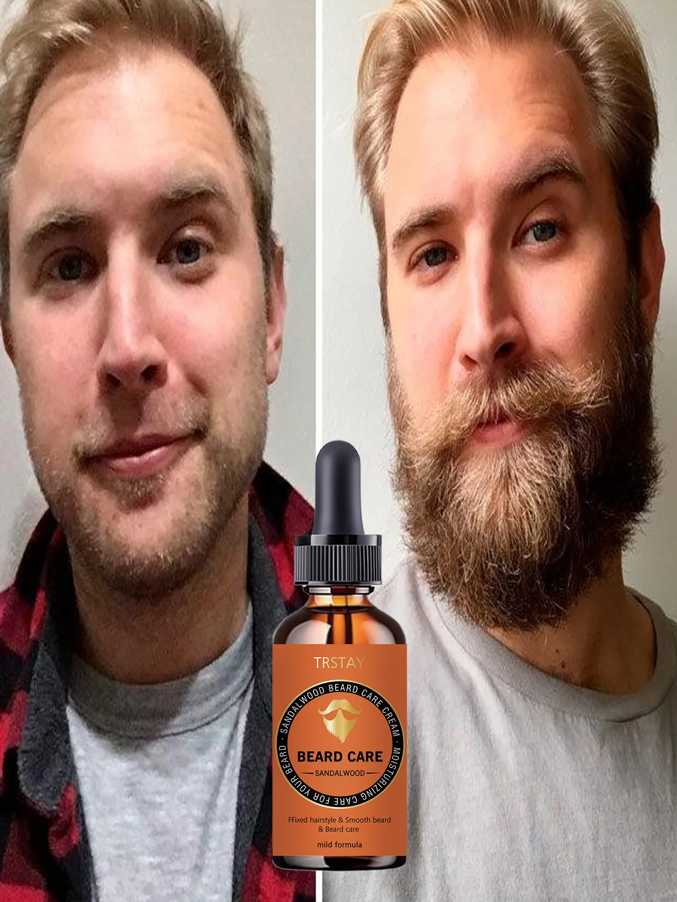 Beard Growth Oil Hydrating Moisturizing Care Stimulates Follicles Thicker Fuller Beard Reduces Breakage Split Ends Soothes Irrit - Image 2