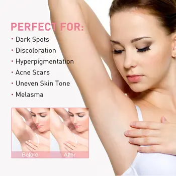 10 best sales Loção corporal clareadora coreana - №1