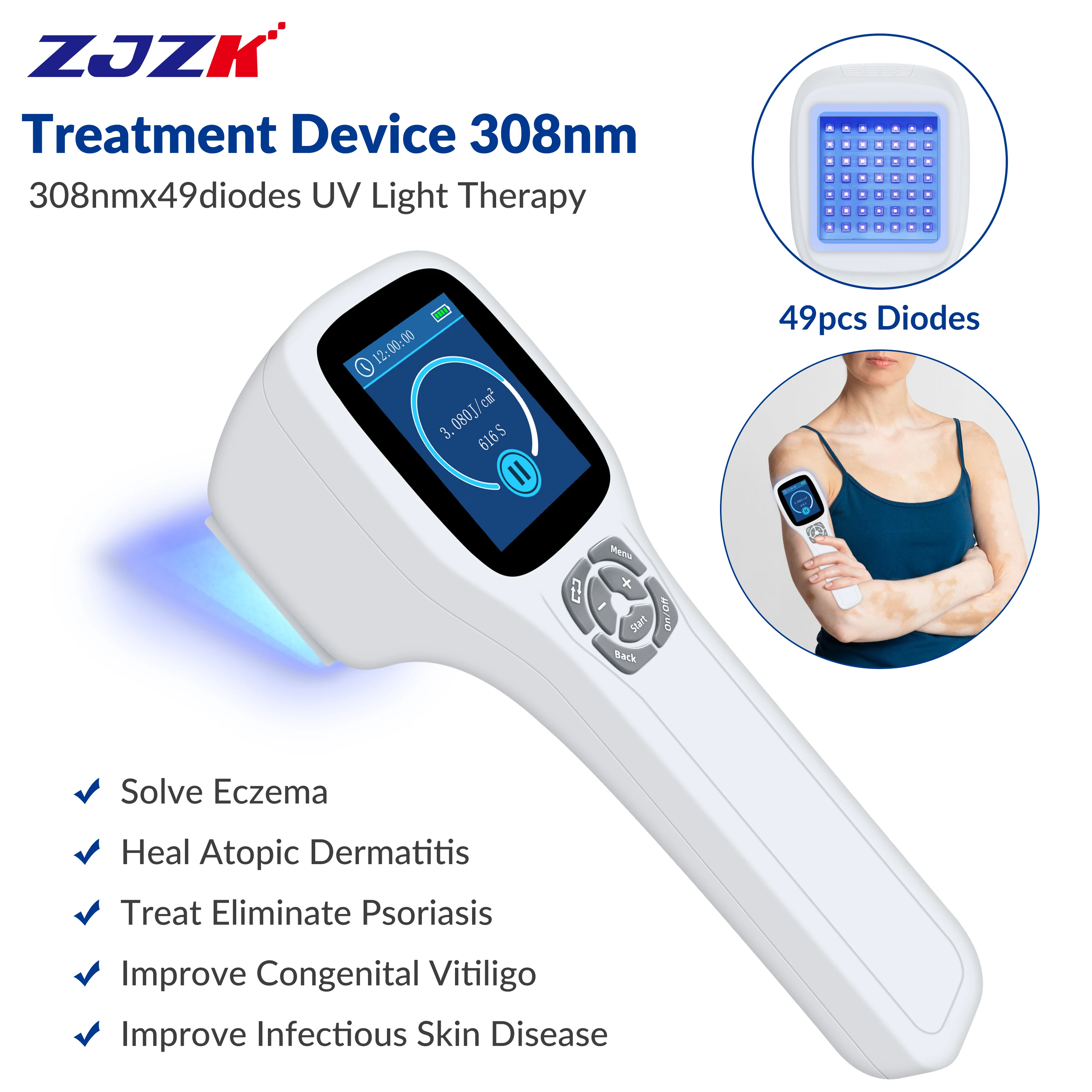 

ZJZK Skin Light Treatment Prurigo Ultraviolet Light Therapy For Vitiligo Near Me 308nmx49diodes Skin Ulcer Nodular Pruritus