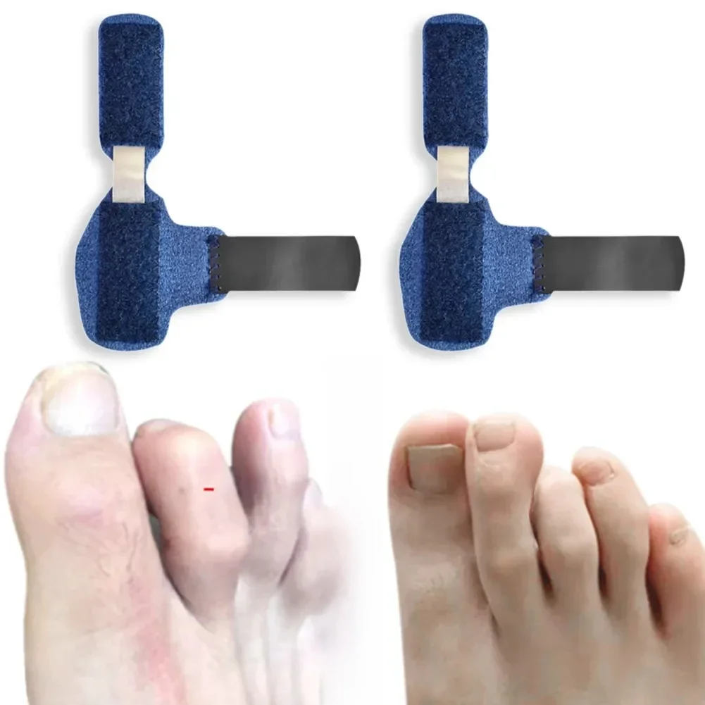 1 pièces orteil attelle lisseur marteau séparateur correcteur doigts tordus griffe stabilisateur Support pieds soin correcteur soulagement de la douleur