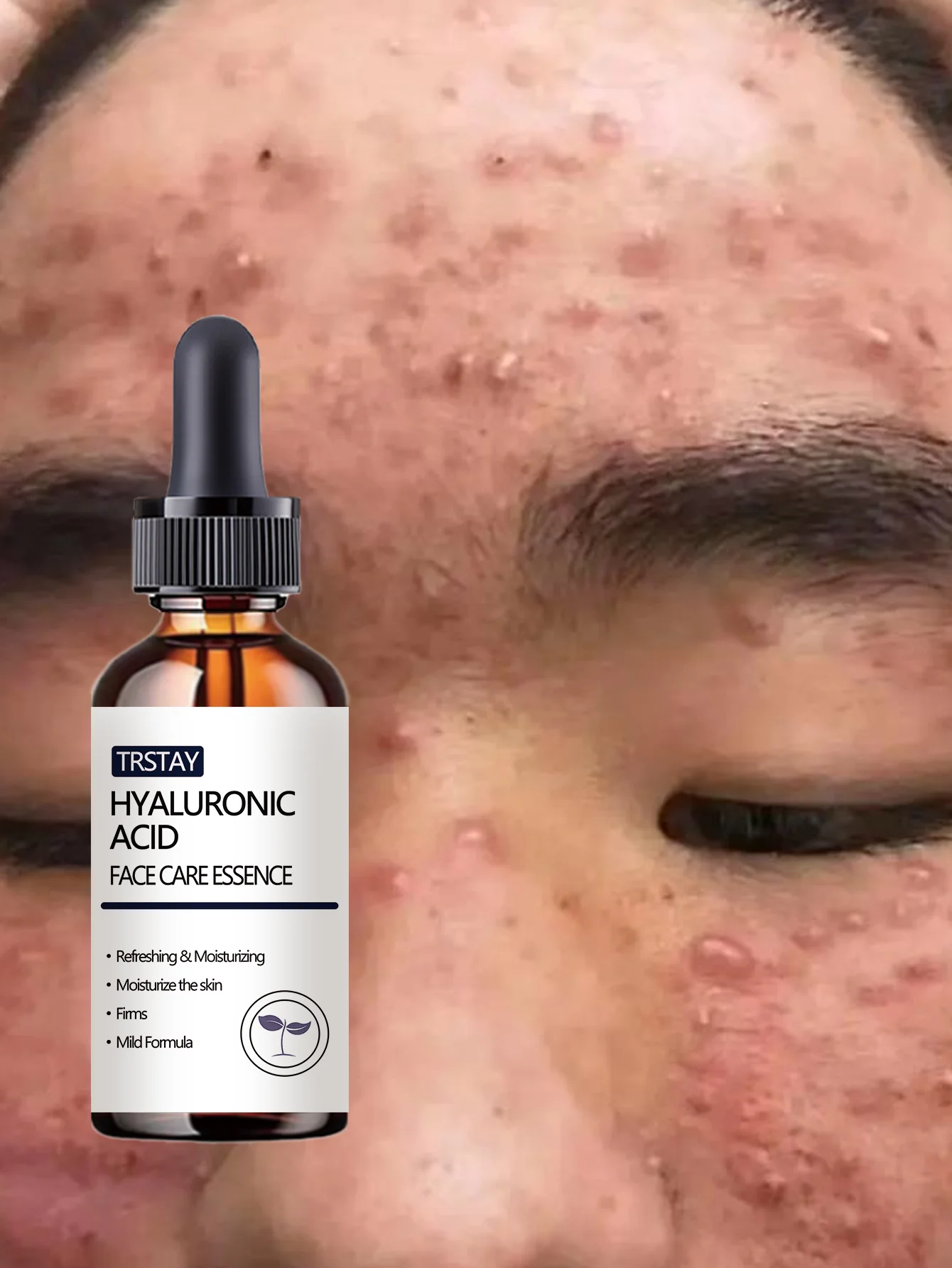 Acne-Fighting Essence, With Plant Extracts, Lightweight & Non-Greasy, Unscented, Suitable for All Skin Types, Hydrating, Gentle - Image 3