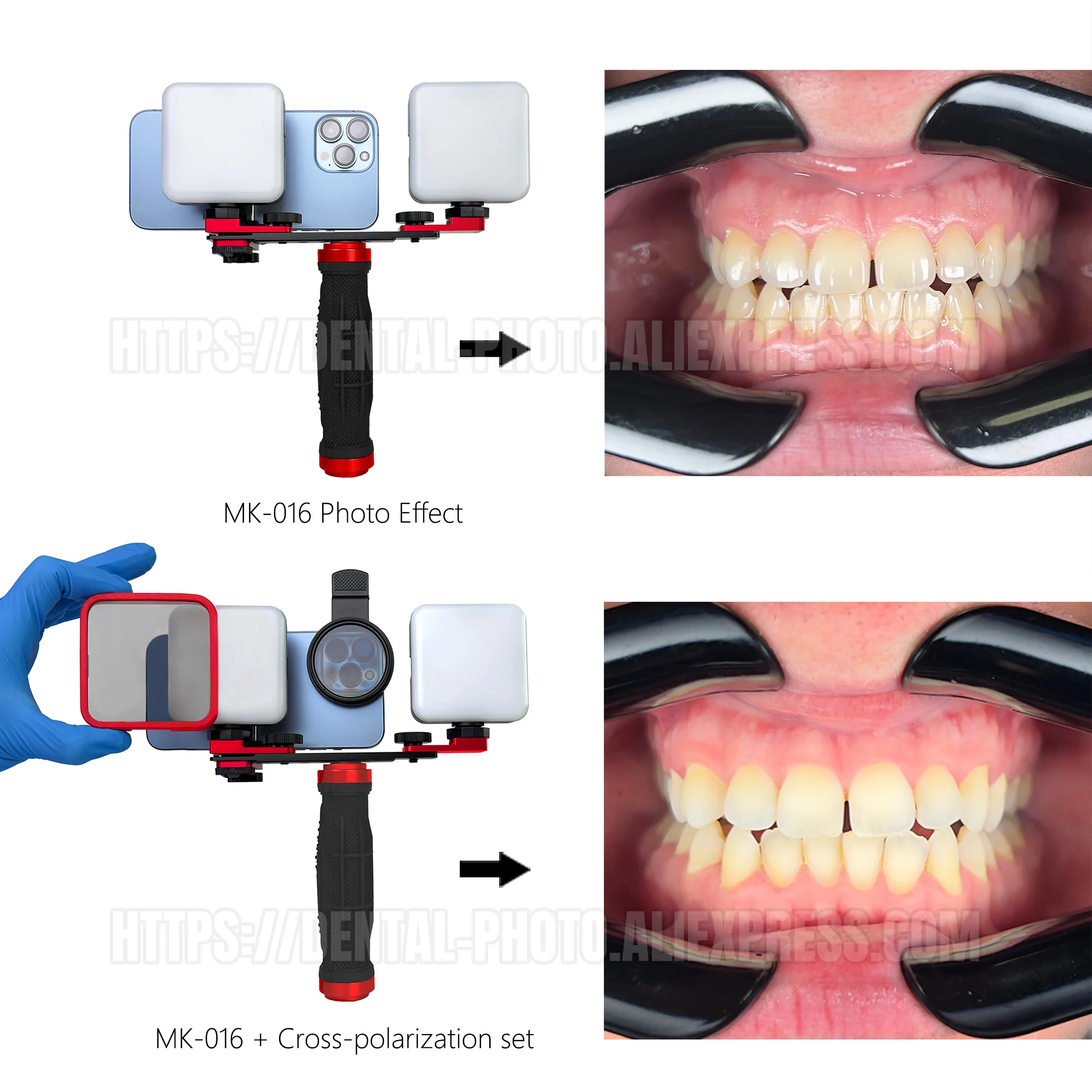 Hera| Cross Polarizing Filters Set For Dental Photography | No Reflections Pictures Smartphone CPL Lens