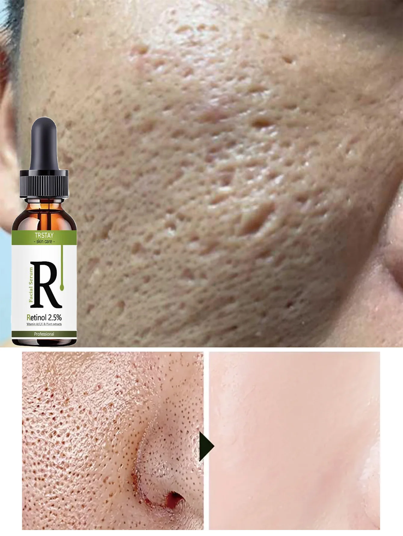 Hydrating Anti Wrinkle Serum Repair Collapsed Barriers Gently Soothe Sensitivity Restore Tender Touch Smooth Skin Facial Treatme - Image 6